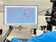 IVI Barcelona avalua la primera IA a Europa per localitzar espermatozoides en els casos més complexos d’infertilitat masculina